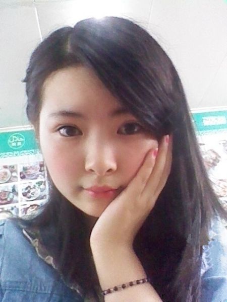 双眼皮术后恢复期多久？可以选择自己喜欢的双眼皮宽度？