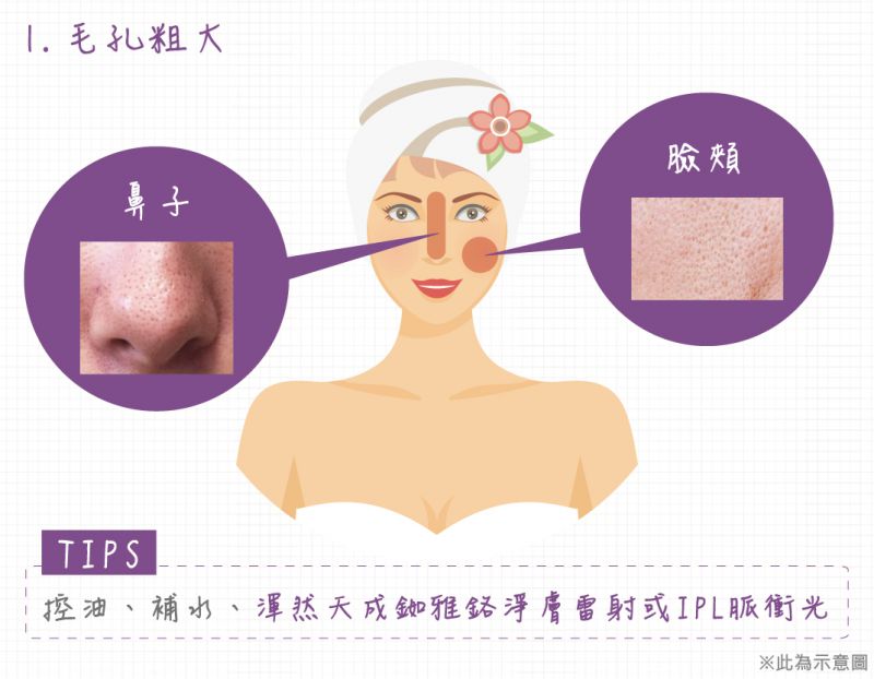 毛孔粗大雀斑黑斑晒斑粉刺痘痘抬头纹鱼尾纹怎么办？