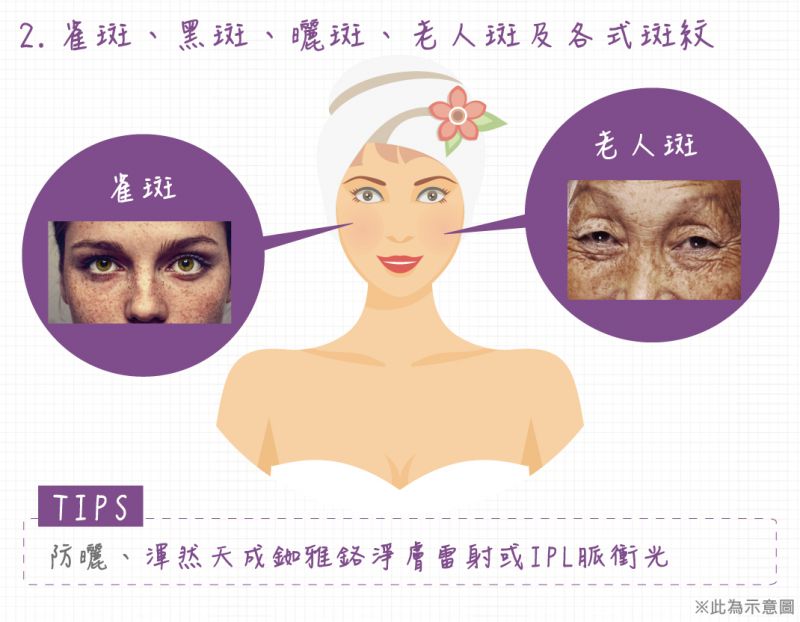 毛孔粗大雀斑黑斑晒斑粉刺痘痘抬头纹鱼尾纹怎么办？