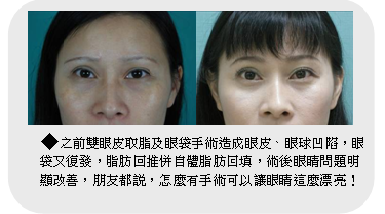 为什么脂肪或玻尿酸注射泪沟难见效果？填充眼袋效果就非常好呢？