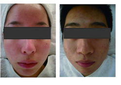 荟草堂专业祛痘连锁机构 卢湾店