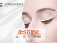 埋线双眼皮