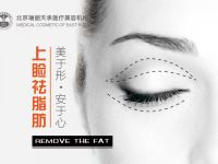 上睑祛脂肪