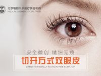 切开双眼皮