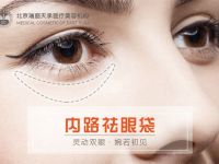 内路祛眼袋